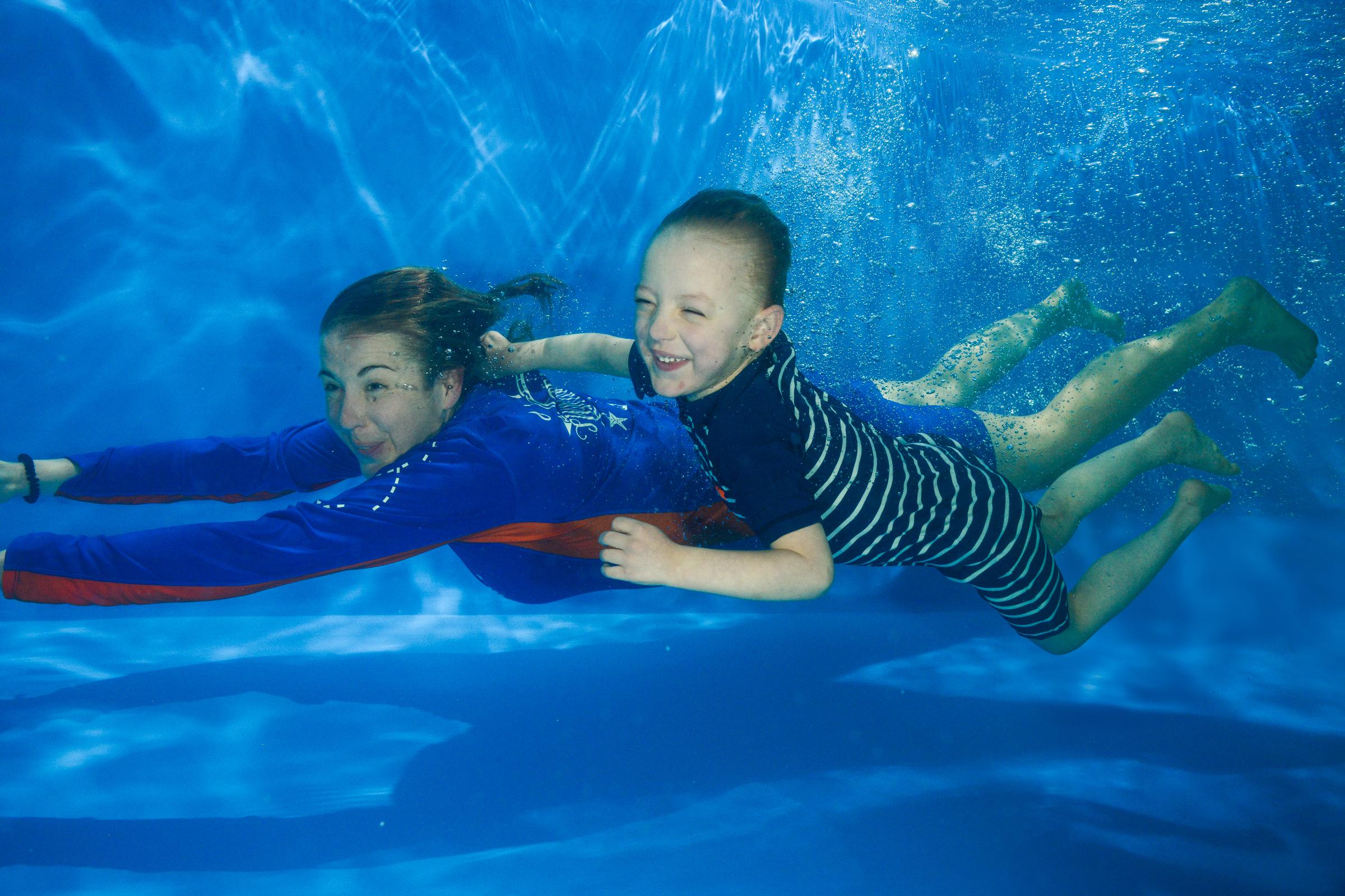 Attending Water Babies with Agenesis of the Corpus Callosum (ACC)